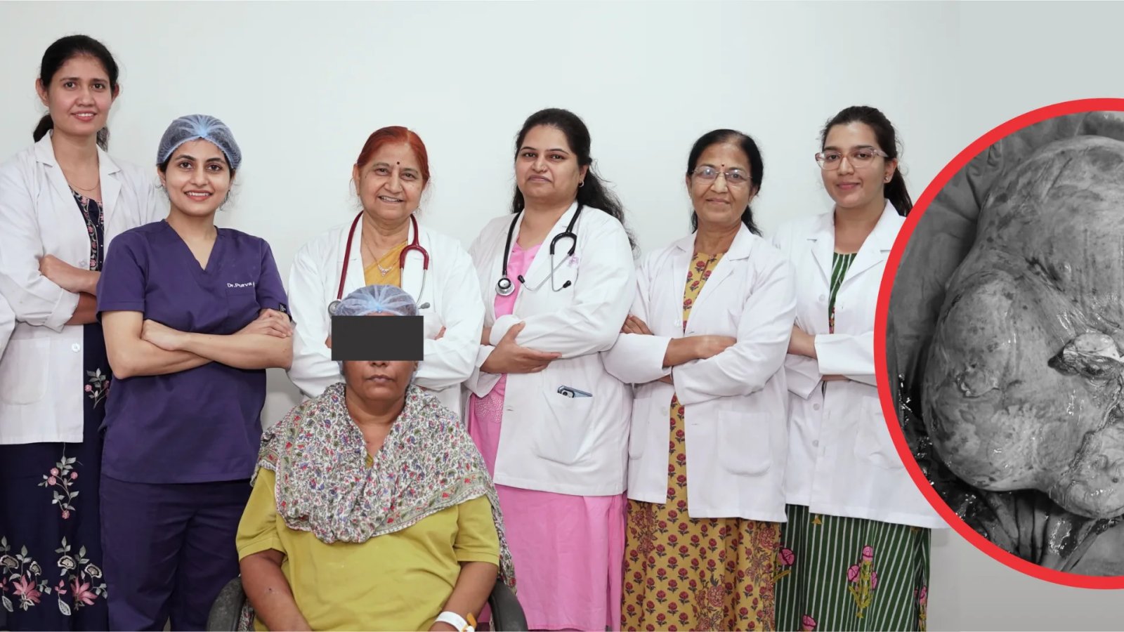 18 साल का दर्द खत्म, गीतांजली हॉस्पिटल में महिला के पेट से निकली 8 किलो की विशाल गांठ